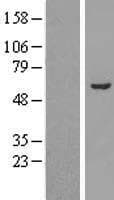 ALDH3A2 Protein (Over-Expression Lysate Myc-DDK (Flag))