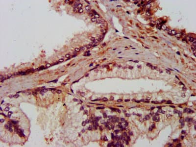 Polyclonal Rabbit anti-Human AMIGO2 Antibody (IHC, IF, WB)