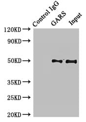 Polyclonal Rabbit anti-Human GARS / Glycyl tRNA Synthetase Antibody (IHC, IF, WB)