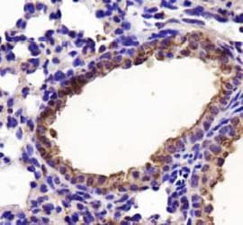 LDHA / LDH1 Antibody (aa280-332, Biotin)