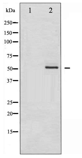 Polyclonal Rabbit anti-Human HDAC2 Antibody (phospho-Ser394, WB)