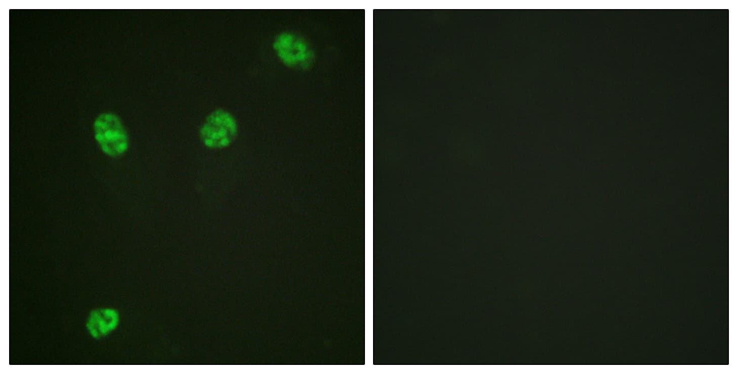 ERF / PE2 Antibody (phospho-Thr526)