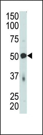 IHC-plus™ PDK4 Antibody (aa382-410)