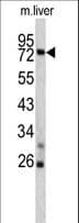 TNFAIP2 Antibody (aa456-484)