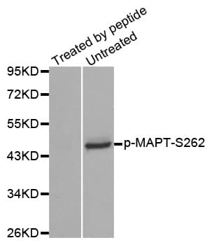 Polyclonal Rabbit anti-Human MAPT / Tau Antibody (phospho-Ser262, IHC, IF, WB)
