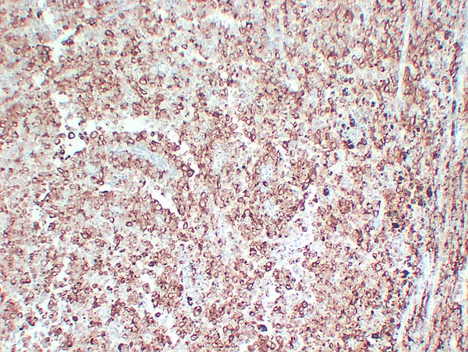 PMEL / SILV / gp100 Antibody (clone ABT-PMEL)