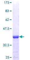 Human RBM17 Protein (Recombinant GST, N-terminus)