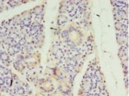 STRADB / ALS2CR2 Antibody