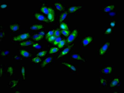 DSG3 / Desmoglein 3 Antibody (aa70-615)