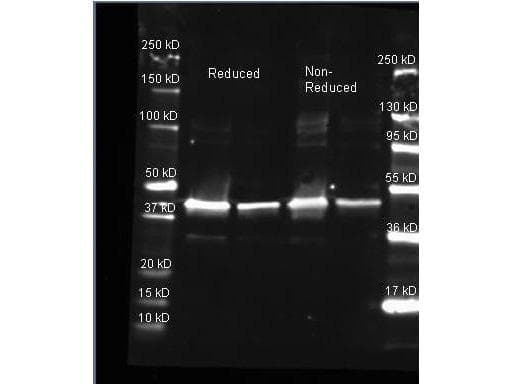 Sarcosine Oxidase Antibody