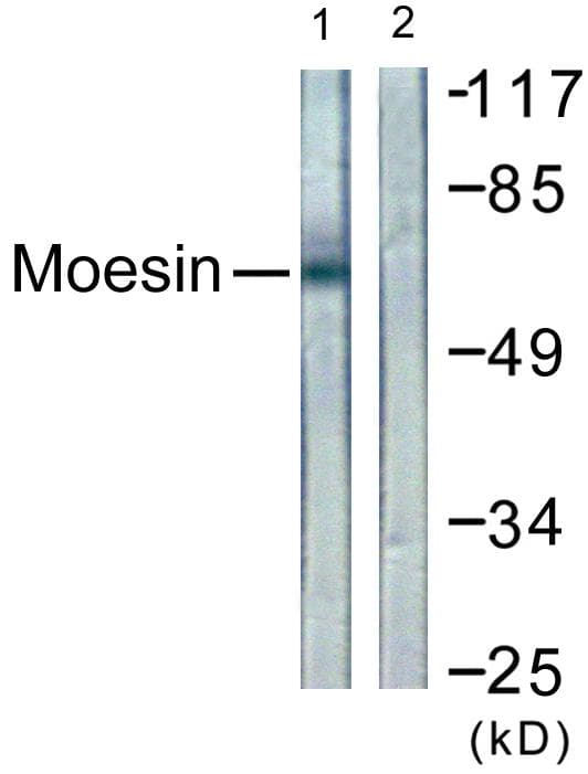 MSN / Moesin Antibody (p558)