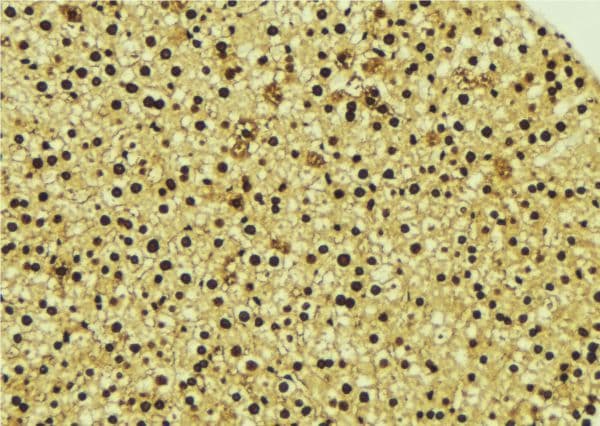TOR1A / Torsin A Antibody