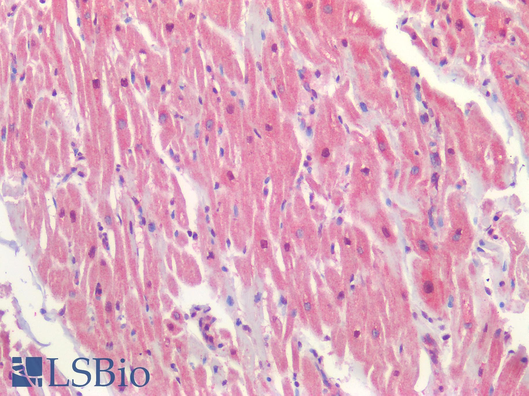 IHC-plus™ P2RX3 / P2X3 Antibody