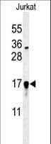 GLRX5 / Glutaredoxin 5 Antibody (aa129-157)