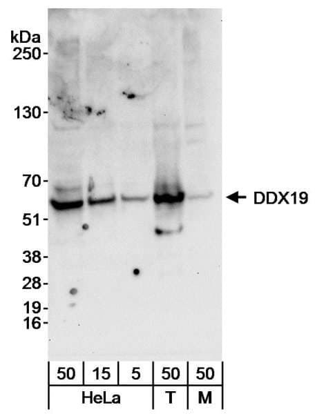 DDX19B Antibody (aa1-50)
