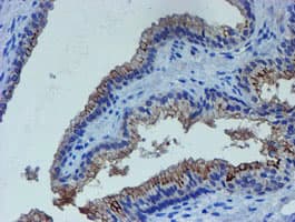 LHX1 Antibody (aa100-362, clone OTI2D5)