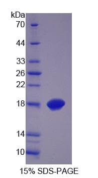 Human GLOD2 / MCEE Protein (Recombinant His, N-Terminal)