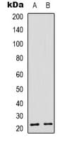 Recoverin Antibody (Internal)