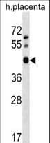 APOBEC3D Antibody (aa46-72)