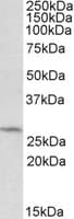 IHC-plus™ DCUN1D1 / SCCRO Antibody (aa248-258)