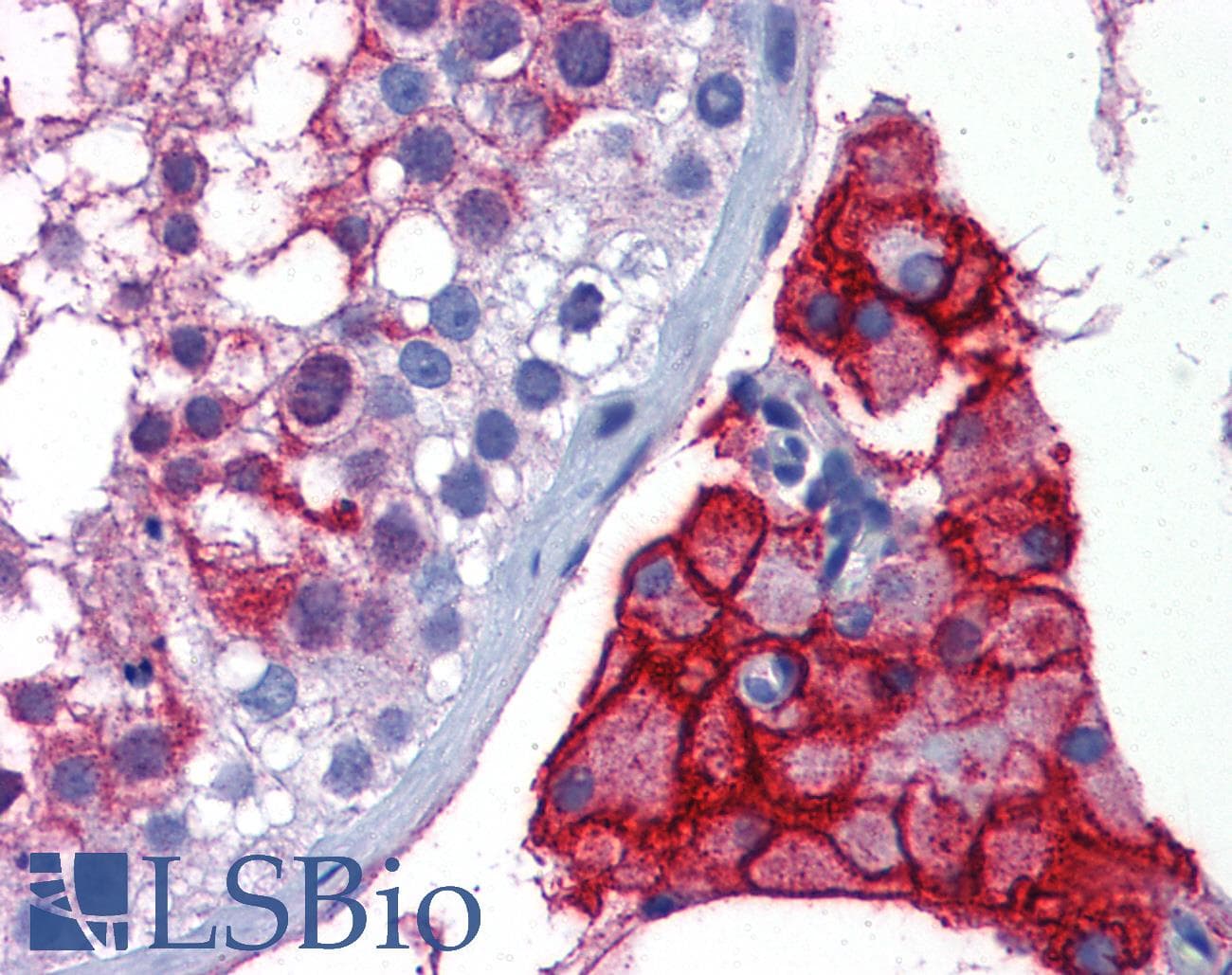 PathPlus™ ACE2 / ACE-2 Antibody (aa684-733)