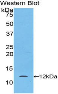 LAMB2 / Laminin Beta 2 Antibody (aa1176-1309, Biotin)