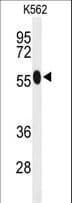 ACSM1 Antibody (aa21-48)
