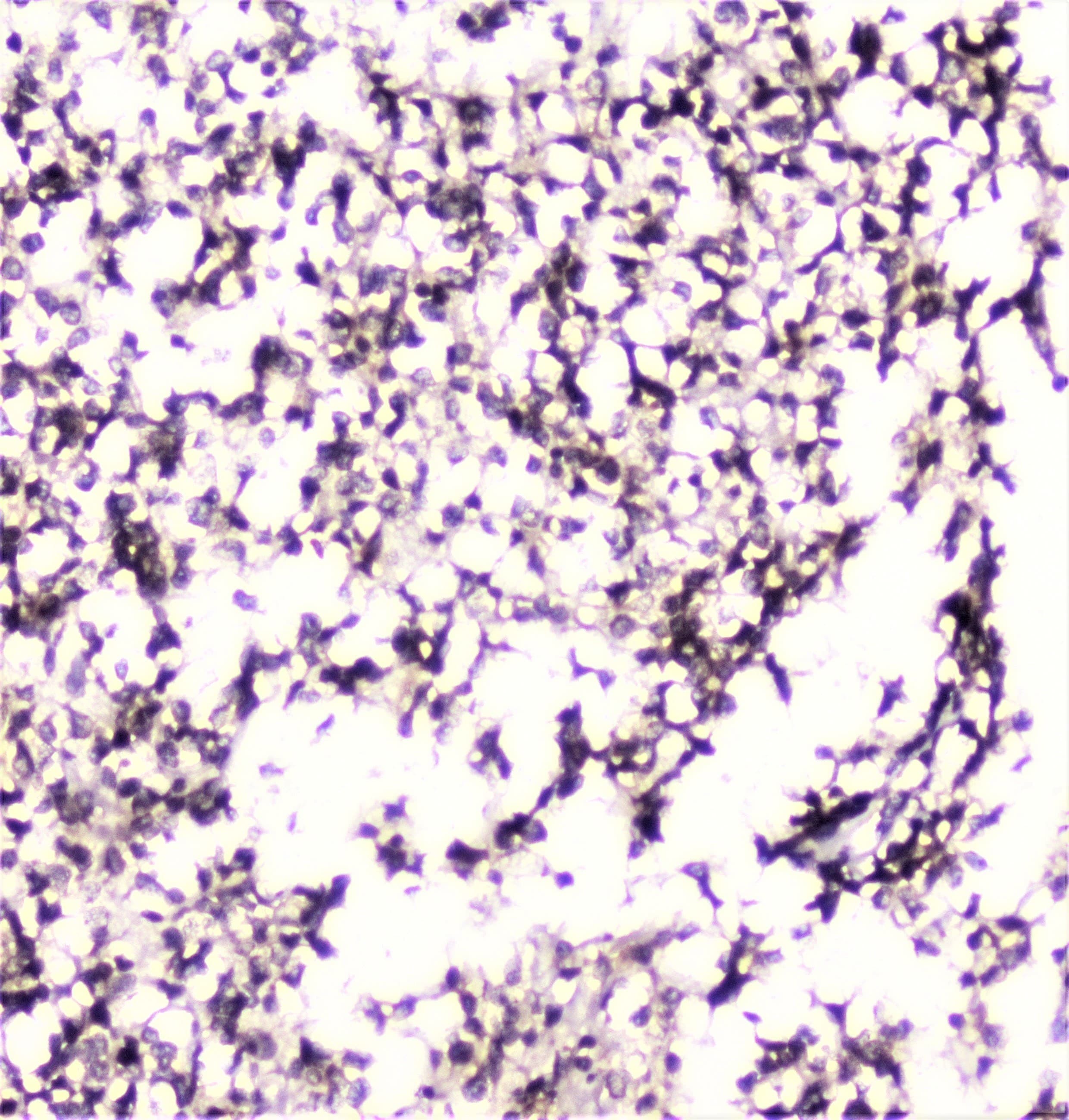 UBE2I / UBC9 Antibody