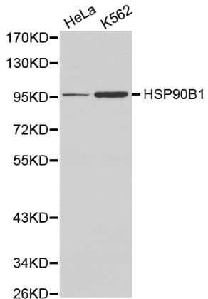 Polyclonal Rabbit anti-Human HSP90B1 / GP96 / GRP94 Antibody (IHC, WB)