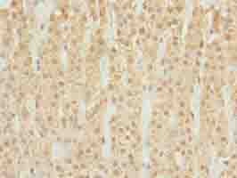 Polyclonal Rabbit anti-Human DHRS3 / SDR1 Antibody (IHC, WB)