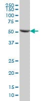 IHC-plus™ Monoclonal Mouse anti-Human DARS Antibody (clone 2F11, IHC, WB)