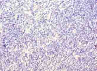 Polyclonal Rabbit anti-Human TRAT1 / TRIM Antibody (IHC)