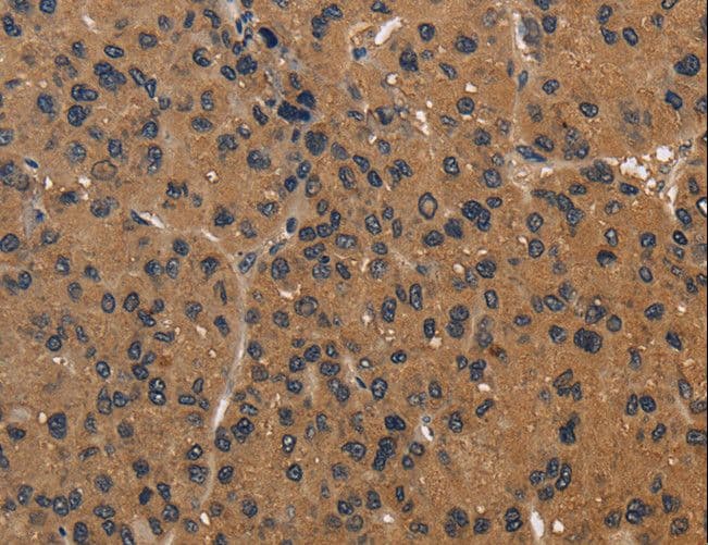 ICAM4 / CD242 Antibody