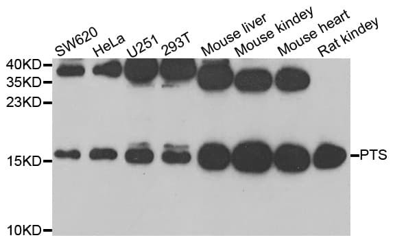 Polyclonal Rabbit anti-Human PTS Antibody (IHC, IF, WB)