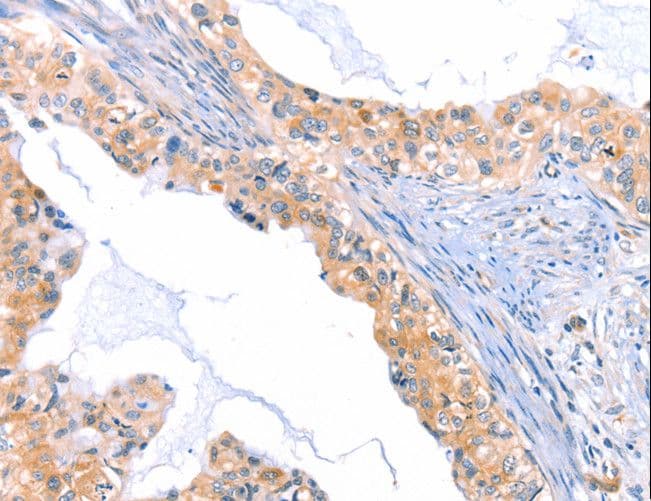 THBS1 / Thrombospondin-1 Antibody