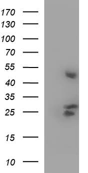 KITLG / SCF Antibody (clone OTI5E9)