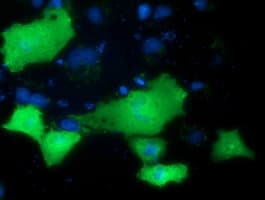 PRKD2 / PKD2 Antibody (clone OTI4F1)