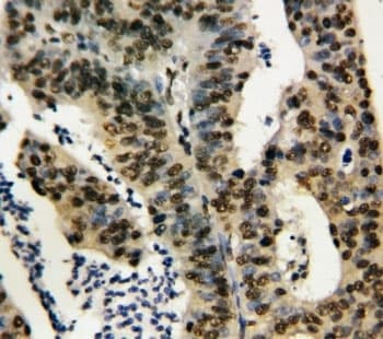 Polyclonal Rabbit anti-Human TNFAIP1 Antibody (aa27-52, IHC, WB)