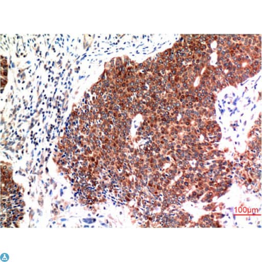 BECN1 / Beclin-1 Antibody