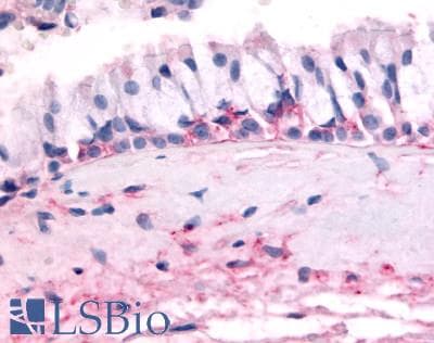 IHC-plus™ OR10J5 Antibody (Extracellular Domain)