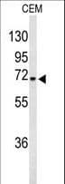 Polyclonal Rabbit anti-Human GABRA4 Antibody (aa350-377, IHC, WB)