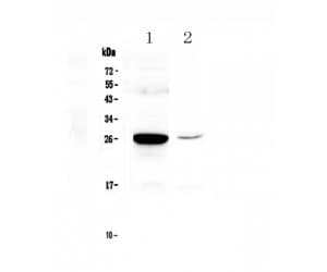Polyclonal Rabbit anti-Mouse MBL2 / Mannose Binding Protein Antibody (WB)