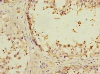 Polyclonal Rabbit anti-Human ANKS1B Antibody (IHC, WB)