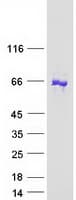 Human ANKRD13C Protein (Recombinant Myc-DDK (Flag))