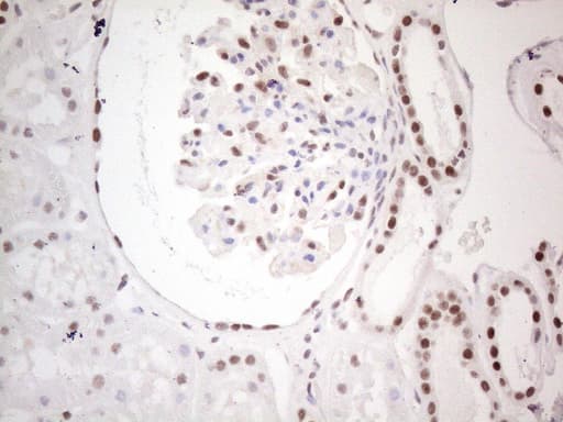 MLH1 Antibody (aa299-527, clone UMAB191)