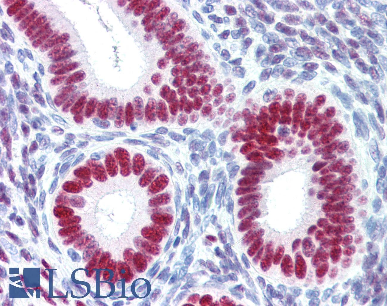 IHC-plus™ Polyclonal Rabbit anti-Human PR / Progesterone Receptor Antibody (C-Terminus, IHC)