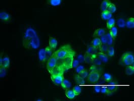 EMA / MUC1 Antibody (clone OTI2F6)