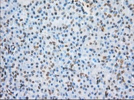 ERCC1 Antibody (clone OTI2A7)
