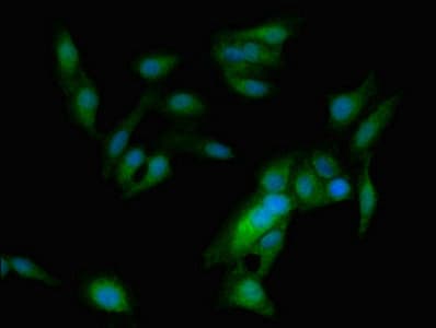 ASPM Antibody