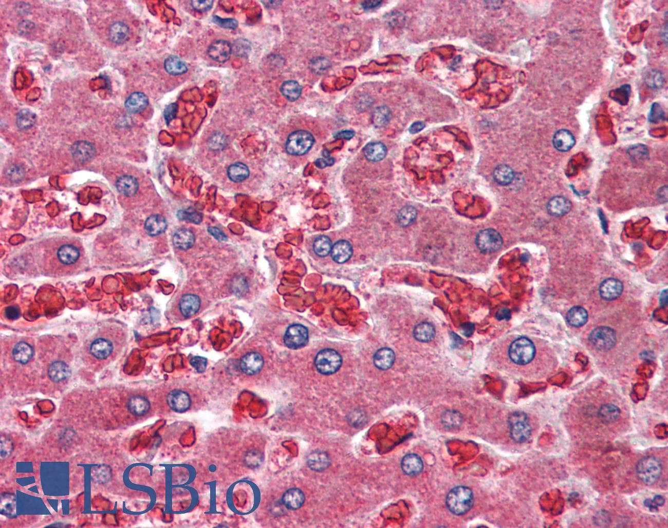IHC-plus™ A2M / Alpha-2-Macroglobulin Antibody (C-Terminus)
